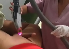 Laser Hair Removal By Indian Nurse